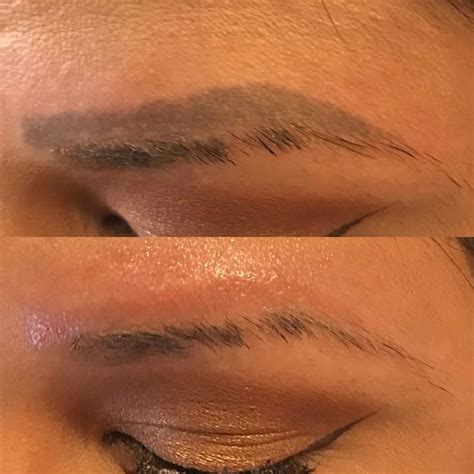 Eyebrow Tattoo Removal Cream