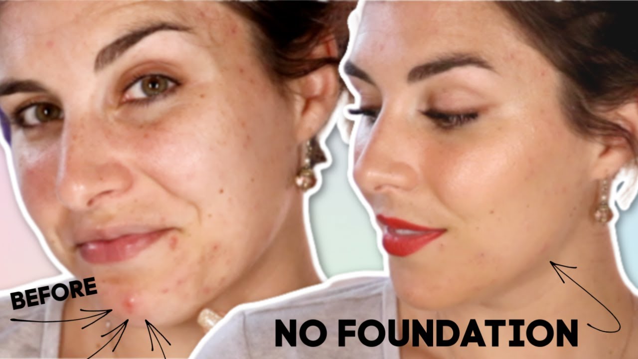 How To Cover Up A Scar On Your Face Without Makeup Makeupview Co