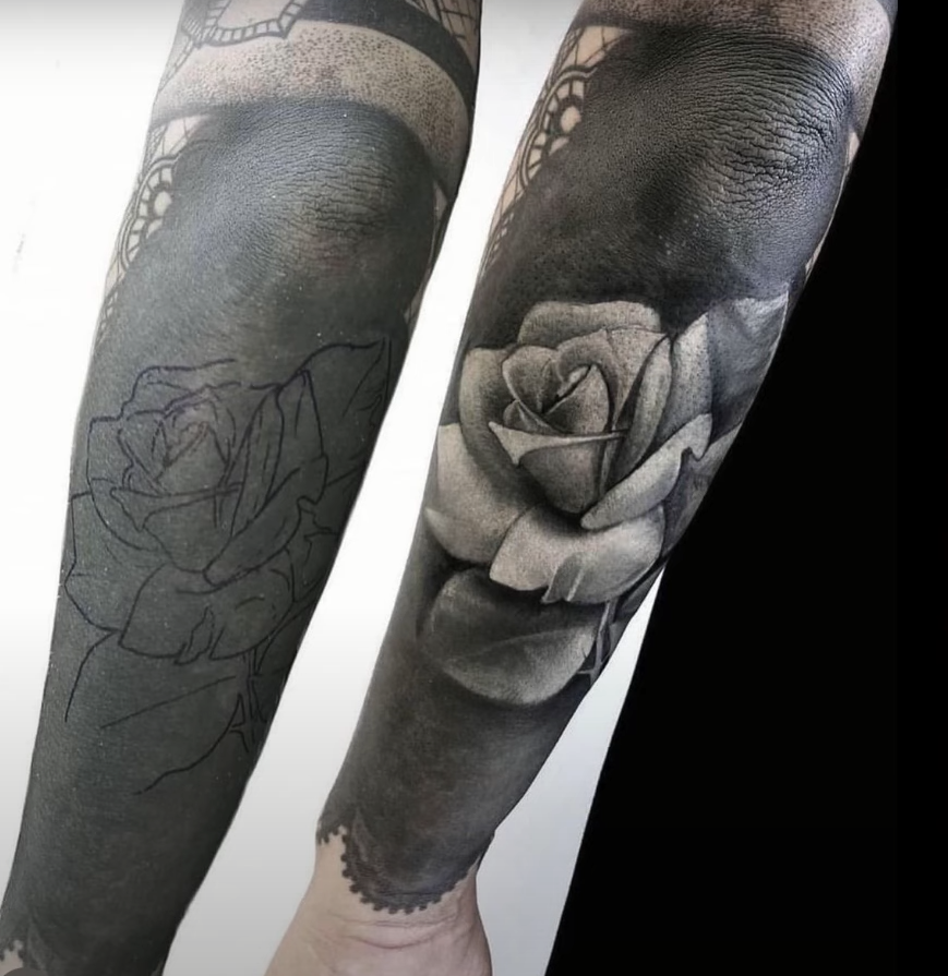 5 Ways to Fix White Ink Over Black Tattoo